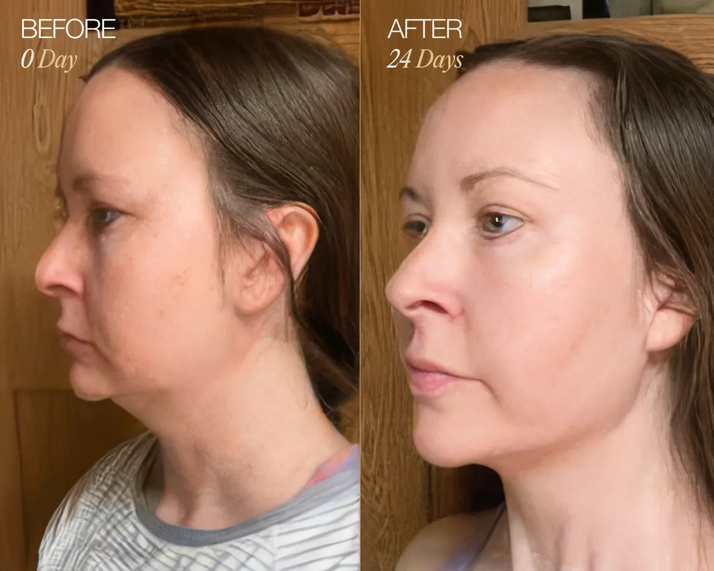 Lymphatic Face Brush ÉLYSE SKIN