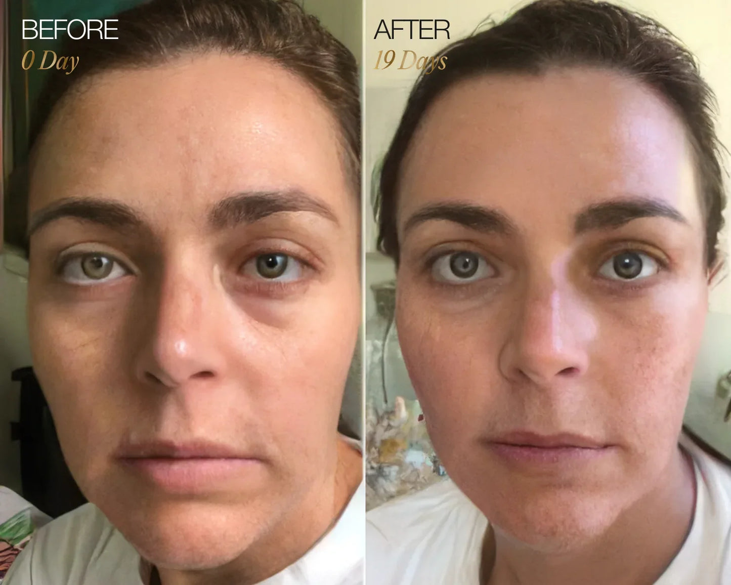 Lymphatic Face Brush ÉLYSE SKIN