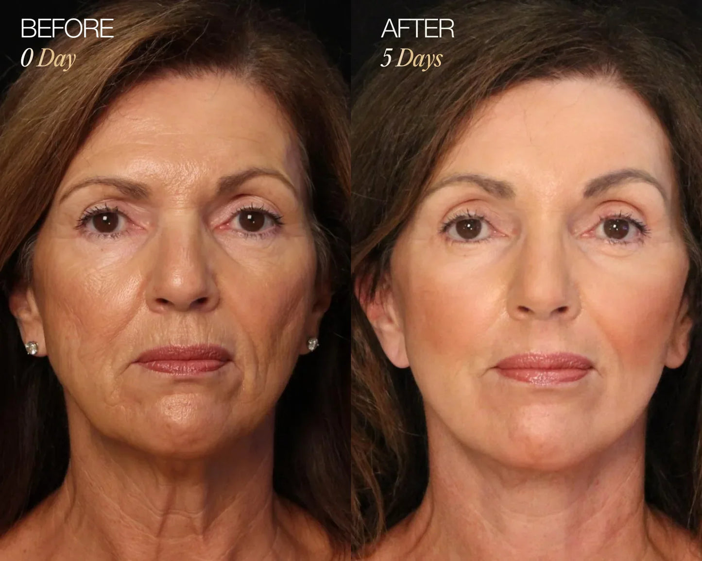 Lymphatic Face Brush ÉLYSE SKIN