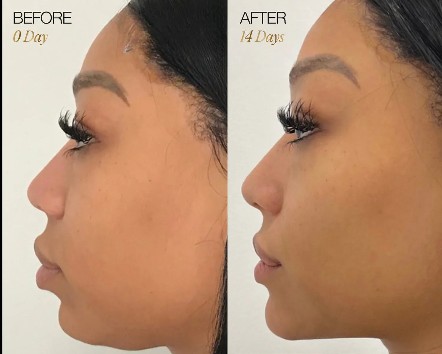 Lymphatic Face Brush ÉLYSE SKIN